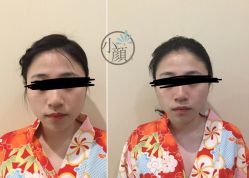 -SEAS小顏·日本小颜整骨美容サロン