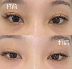 -广州曙光医学美容医院