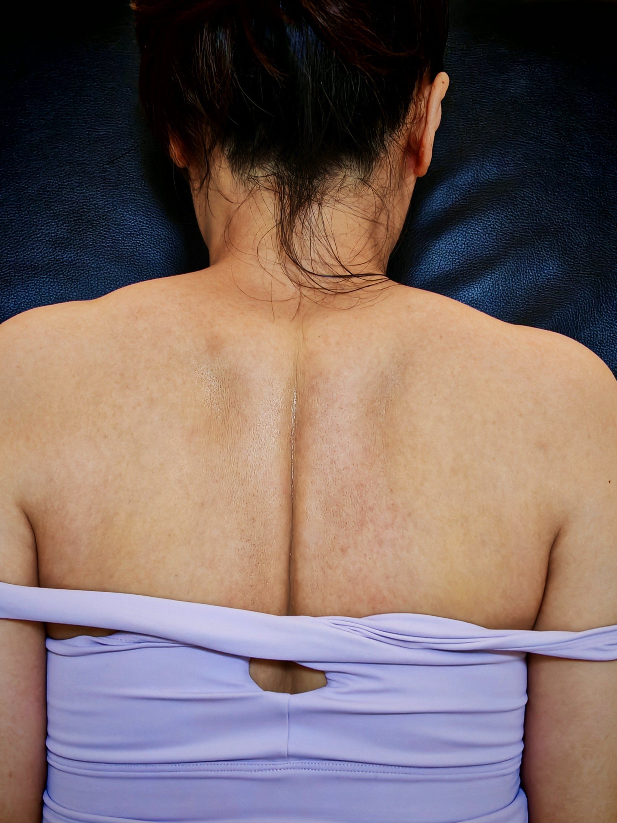 揭秘背部保养的小技巧