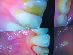 -新达口腔(华东理工大学店)