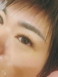 点击看大图 -郡艺医疗美容·微整·眼鼻吸脂