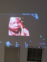 -郑州万安妇产医院