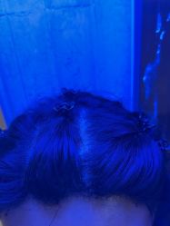 -碧莲盛·不剃发植发