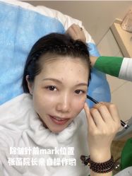 -联合丽格·张菡丽格医疗美容