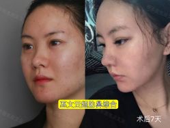 -北京米扬丽格医疗美容·联合丽格鼻整形中心