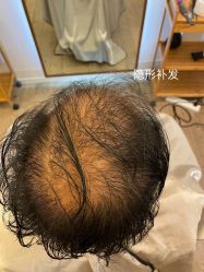 点击看大图 -乐绅男士高端假发定制