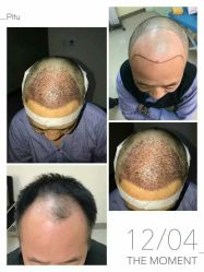 体验后-厦门美莱整形美容医院