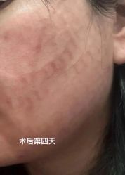 -新地崔劲松医疗美容