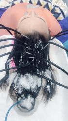 -黑奥秘脱发白发中心