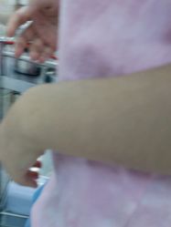 -悟空祛痘·诺奖技术专业店