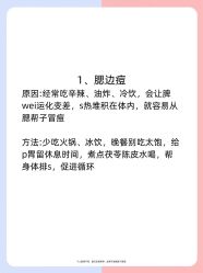 -克丽缇娜