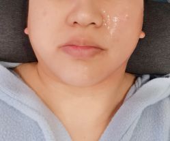 体验后-圣嘉新医疗美容医院