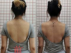 -修申骨雕小颜脊柱骨盆管理产后修复