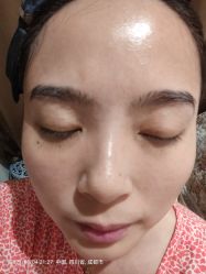 体验后-成都大华医学美容医院