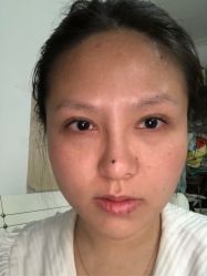 体验前-繁星轻医美连锁