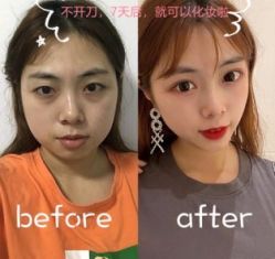 -天津健丽·去眼袋医疗美容机构