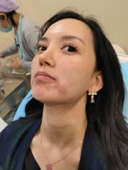 -北京米扬丽格医疗美容·联合丽格鼻整形中心