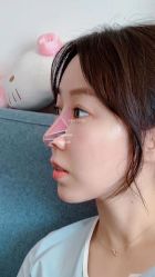 -北京米扬丽格医疗美容·联合丽格鼻整形中心