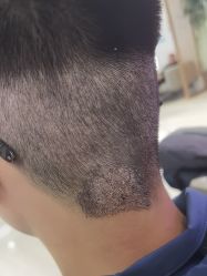 -雍禾植发全国连锁