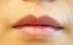 -植蔻妍倍儿专业脱毛·皮肤管理