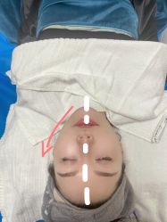 体验前-禾美嘉医疗美容