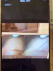 -苑苑vbeauty科技美容SPA
