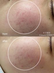 -E.beauty驻颜·痘敏肌调理中心