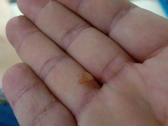 -新甲连锁灰指甲·甲沟炎·鸡眼(黑龙江路店)