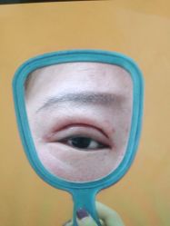 体验后-西安壹加壹医疗美容·西北抗衰旗舰店