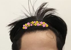 -大麦微针植发全国连锁