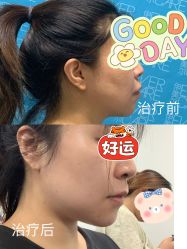 -天津伊美尔医疗整形美容专科医院