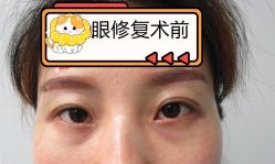 -素美医疗美容·西南眼鼻整形·修复基地