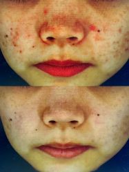 -和颜一美轻医美连锁