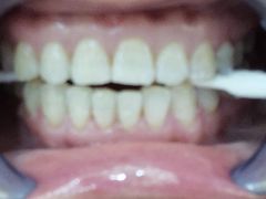 -Dr.Z dental仁康种植矫正中心