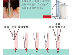 -团圆口腔·种植中心(锦江院区)