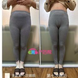 点击看大图 -产后帮产后修复(首城国际店)