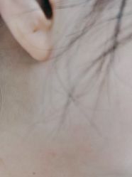 -美瑞莎创美医疗美容