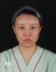 -北京米扬丽格医疗美容·联合丽格鼻整形中心