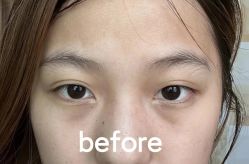 -天津健丽·去眼袋医疗美容机构