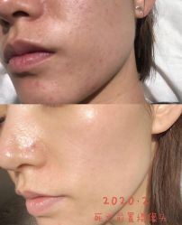 -苗方清颜痘肌研究所