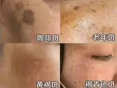 -中粮·祥云小镇