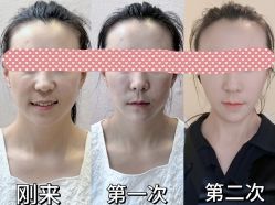 -颜和骨正·明哲式骨相美学整骨