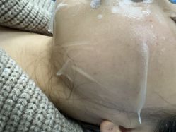 -长沙雅美医疗美容医院