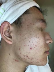 -友仟痘医生科学祛痘连锁