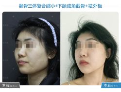 -圣嘉新医疗美容医院