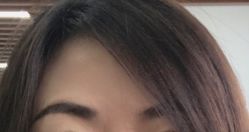 体验后-洁铭新加坡医美