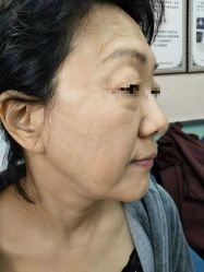 -北京美痣堂古方祛痣斑疣瘊