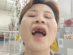 -极爱攀岩