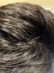 -熙朵美学植发·连锁品牌