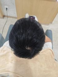 -大麦微针植发丨全国连锁